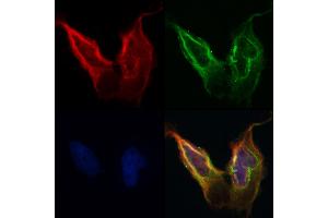 ABIN6260703 and ABIN6268787 staining Hela by IF/ICC. (N-Cadherin anticorps  (C-Term))