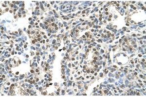 Immunohistochemical staining (Formalin-fixed paraffin-embedded sections) of human lung with MAGEA8 polyclonal antibody . (MAGEA8 anticorps  (AA 51-100))