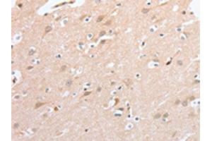 The image on the left is immunohistochemistry of paraffin-embedded Human brain tissue using ABIN7131058(SIGLEC9 Antibody) at dilution 1/40, on the right is treated with fusion protein. (SIGLEC9 anticorps)