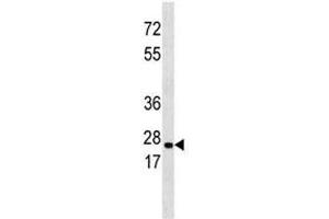 ERAB antibody western blot analysis in 293 lysate (Endoplasmic Reticulum Amyloid Binding Protein (ERAB) (AA 199-235) anticorps)