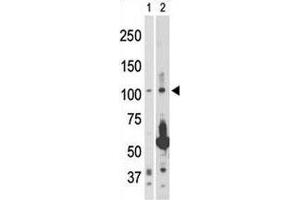 NIK antibody used in western blot to detect NIK in 293 cell lysate (Lane 1) and rat testis tissue lysate (2). (MAP3K14 anticorps  (AA 119-148))