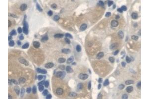 Detection of ANTXR2 in Human Stomach Tissue using Polyclonal Antibody to Anthrax Toxin Receptor 2 (ANTXR2)