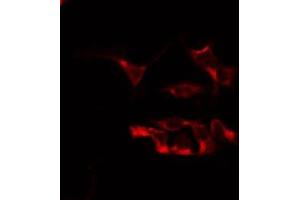 ABIN6266693 staining Hela by IF/ICC.