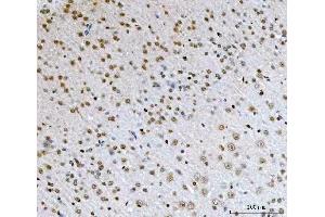 IHC analysis of AREB6/ZEB1 using anti-AREB6/ZEB1 antibody (ABIN7602990).