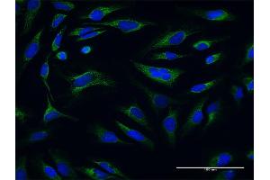 Immunofluorescence of purified MaxPab antibody to ATP5O on HeLa cell. (ATP5O anticorps  (AA 1-213))