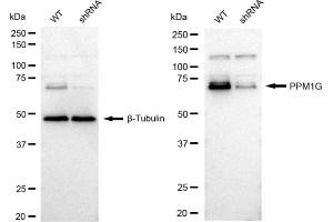 Western blotting analysis using PPM1G antibody (ABIN7800034).