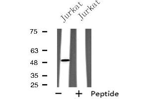 Western blot analysis of extracts from Jurkat cells, using GPR142 antibody. (GPR142 anticorps  (Internal Region))
