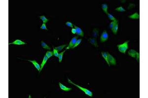 Immunofluorescent analysis of Hela cells using ABIN7173542 at dilution of 1:100 and Alexa Fluor 488-congugated AffiniPure Goat Anti-Rabbit IgG(H+L) (C22orf28 anticorps  (AA 52-229))