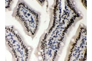 IHC testing of FFPE mouse intestine with CSNK1A1 antibody. (CSNK1A1 anticorps)