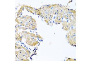 Immunohistochemistry of paraffin-embedded mouse heart using GPLD1 antibody (ABIN5973975) at dilution of 1/100 (40x lens). (GPLD1 anticorps)