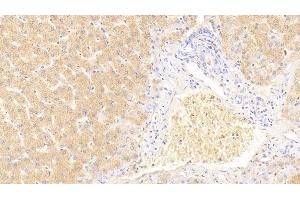 Detection of GDN in Human Liver Tissue using Polyclonal Antibody to Glia Derived Nexin (GDN) (SERPINE2 anticorps  (AA 20-398))