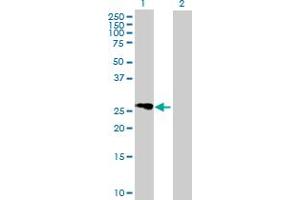 Western Blot analysis of FLJ25006 expression in transfected 293T cell line by FLJ25006 MaxPab polyclonal antibody. (FLJ25006 (AA 1-274) anticorps)
