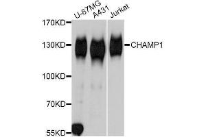 Western blot analysis of extracts of various cell lines, using CHAMP1 Antibody. (ZNF828 anticorps  (AA 563-812))