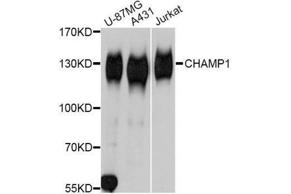 ZNF828 anticorps  (AA 563-812)