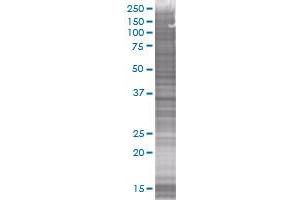 AKR1B1 transfected lysate. (AKR1B1 293T Cell Transient Overexpression Lysate(Denatured))