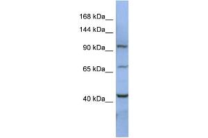 WB Suggested Anti-RBM12 Antibody Titration:  0. (RBM12 anticorps  (N-Term))