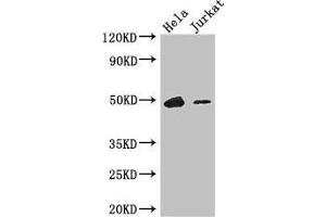 Western Blot Positive WB detected in: Hela whole cell lysate, Jurkat whole cell lysate All lanes: IKZF1 antibody at 3. (IKZF1 anticorps  (AA 1-265))