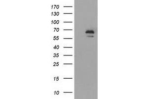 Western Blotting (WB) image for anti-Insulin-Like Growth Factor 2 mRNA Binding Protein 2 (IGF2BP2) antibody (ABIN1498826) (IGF2BP2 anticorps)