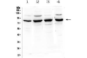 Western blot analysis of SEMA3B using anti-SEMA3B antibody (ABIN6719617).