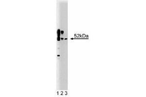 Western blot analysis of CaM Kinase II on a rat cerebrum lysate (First Panel). (CAMK2A anticorps  (AA 448-460))