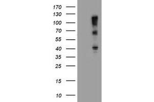 Western Blotting (WB) image for anti-F-Box Protein 31 (FBXO31) antibody (ABIN1498239) (FBXO31 anticorps)