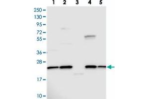 Western blot analysis of Lane 1: RT-4, Lane 2: U-251 MG, Lane 3: Human Plasma, Lane 4: Liver, Lane 5: Tonsil with NPVF polyclonal antibody . (NPVF anticorps)
