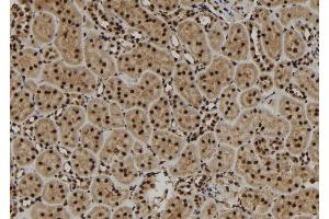 ABIN6279839 at 1/100 staining Rat kidney tissue by IHC-P. (SCNM1 anticorps)