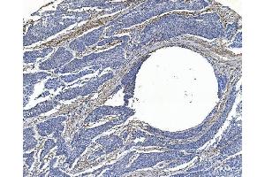 IHC analysis of Filamin A/FLNA using anti-Filamin A/FLNA antibody (ABIN7601783). (Filamin A anticorps  (AA 451-638))