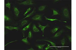 Immunofluorescence of purified MaxPab antibody to QARS on HeLa cell.