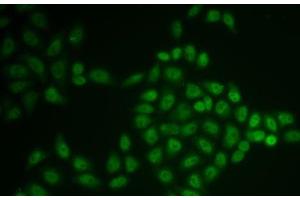Immunofluorescence analysis of U2OS cells using BTG1 Polyclonal Antibody (BTG1 anticorps)
