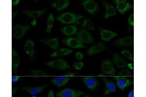 Immunofluorescence analysis of L929 cells using NDUFB7 Polyclonal Antibody at dilution of 1:100 (40x lens).