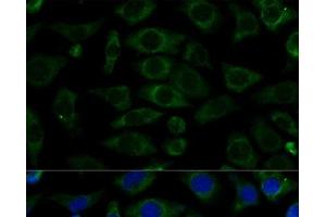 Immunofluorescence analysis of L929 cells using NDUFB7 Polyclonal Antibody at dilution of 1:100 (40x lens). (NDUFB7 anticorps)