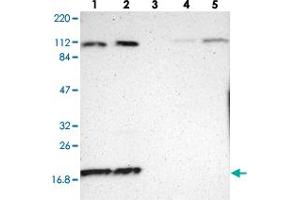 Western blot analysis of Lane 1: RT-4, Lane 2: U-251 MG, Lane 3: Human Plasma, Lane 4: Liver, Lane 5: Tonsil with RPL12 polyclonal antibody  at 1:250-1:500 dilution.