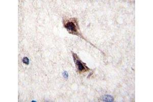 IHC analysis of FFPE human brain tissue stained with MEF2C antibody