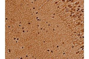 ABIN6276980 at 1/200 staining human brain tissue sections by IHC-P. (TRIM21 anticorps  (C-Term))