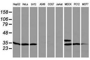 Image no. 1 for anti-Protein tyrosine Phosphatase, Non-Receptor Type 7 (PTPN7) antibody (ABIN1500502) (PTPN7 anticorps)
