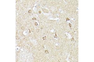 Immunohistochemistry of paraffin-embedded human brain using CX3CL1 Rabbit pAb (ABIN6129035, ABIN6139265, ABIN6139266 and ABIN6218481) at dilution of 1:150 (40x lens).