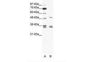 Image no. 1 for anti-Zinc Finger Protein 488 (ZNF488) (C-Term) antibody (ABIN202284) (ZNF488 anticorps  (C-Term))