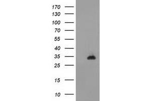 Image no. 1 for anti-CTD (Carboxy-terminal Domain, RNA Polymerase II, Polypeptide A) Small Phosphatase 1 (CTDSP1) antibody (ABIN1497680) (CTDSP1 anticorps)