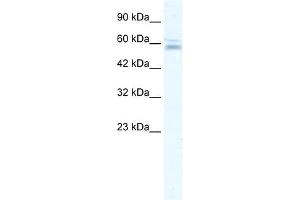WB Suggested Anti-ZNF141 Antibody Titration:  2. (ZNF141 anticorps  (N-Term))