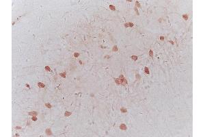 Formalin-fixed and frozen mouse brain labeled with Anti-NRSF REST Polyclonal Antibody, unconjugated (ABIN747683) at 1:200 followed by incubation with conjugated secondary antibody