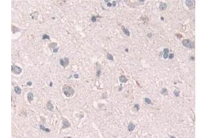 Detection of Grb10 in Human Cerebrum Tissue using Polyclonal Antibody to Growth Factor Receptor Bound Protein 10 (Grb10)