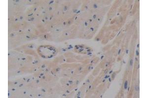 IHC-P analysis of Mouse Heart Tissue, with DAB staining. (ABCA1 anticorps  (AA 1404-1663))