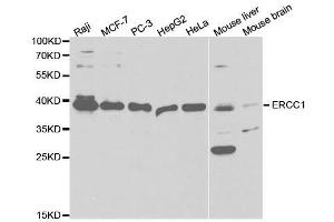 Western blot analysis of extracts of various cell lines, using ERCC1 antibody. (ERCC1 anticorps  (AA 1-323))