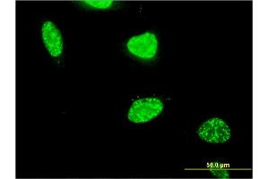 Immunofluorescence of monoclonal antibody to PAXIP1 on HeLa cell. (PAXIP1 anticorps  (AA 868-975))
