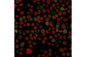 Immunofluorescence staining of paraformaldehyde-fixed Ramos cells with CD22 Mouse Monoclonal Antibody (BLCAM/1796) followed by goat anti-Mouse IgG-CF488 (Green).