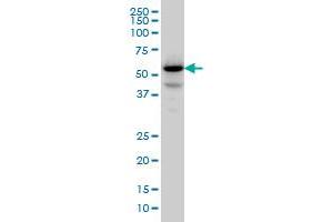 PPM1F monoclonal antibody (M01), clone 2A9 Western Blot analysis of PPM1F expression in Jurkat . (PPM1F anticorps  (AA 1-100))