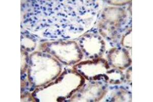 Immunohistochemistry analysis in human kidney tissue (Formalin-fixed, Paraffin-embedded) using NKD2 Antibody (C-term), followed by peroxidase conjugated secondary antibody and DAB staining.