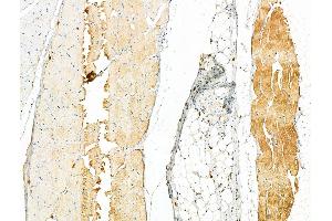 ABIN6259069 and ABIN6275809 at 1/100 staining Rat skin tissue by IHC-P.