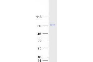 Validation with Western Blot (SPINT1 Protein (Transcript Variant 1) (Myc-DYKDDDDK Tag))